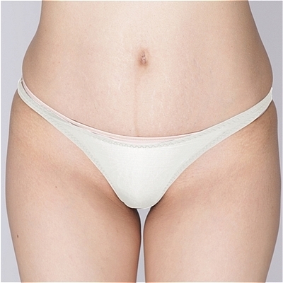 �ɔ��X�g���b�`�n�C���O�n�[�t�o�b�N�@�z���C�g