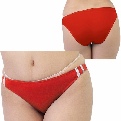 �Q�������X�g���b�`�u���}�n�[�t�o�b�N�@���b�h